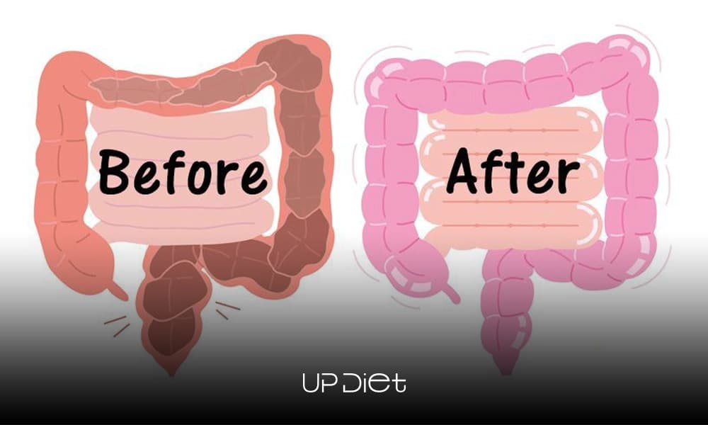 The Poop Diet: Decode Your Stool and Beat Constipation Naturally